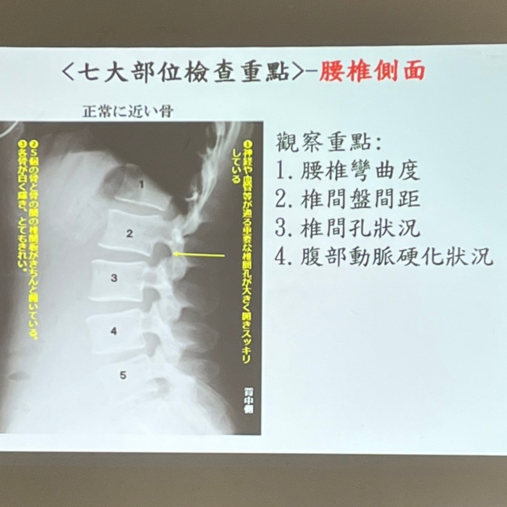 113年9月-健骨防鬆新觀念